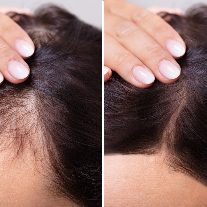Myhairvitamins - Hairserum myhairvitamins